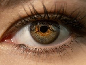 Penyebab Mata Panda karena Resistensi Insulin?