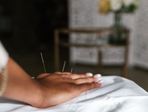 Akupuntur untuk Pemulihan Stroke?