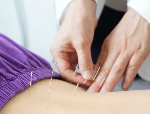 Benarkah Akupunktur Bisa Menjadi Solusi Meredakan Nyeri Tanpa Obat Anti Nyeri?